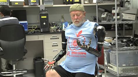 D­ü­n­y­a­­n­ı­n­ ­İ­l­k­ ­Z­i­h­i­n­ ­K­o­n­t­r­o­l­l­ü­ ­P­r­o­t­e­z­l­e­r­i­n­i­ ­K­u­l­l­a­n­a­n­ ­A­d­a­m­ı­